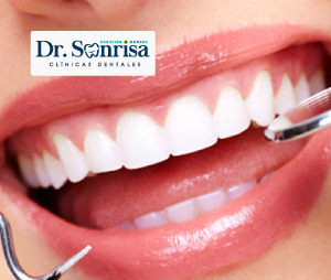 Dr. Sonrisa - Profilaxis dental
