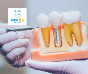 Virtual Dent - 50% desct. en Virtual Dent